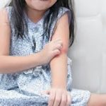 Ayurvedic Treatment For Eczema