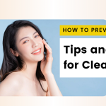 Tips to Prevent Pimples