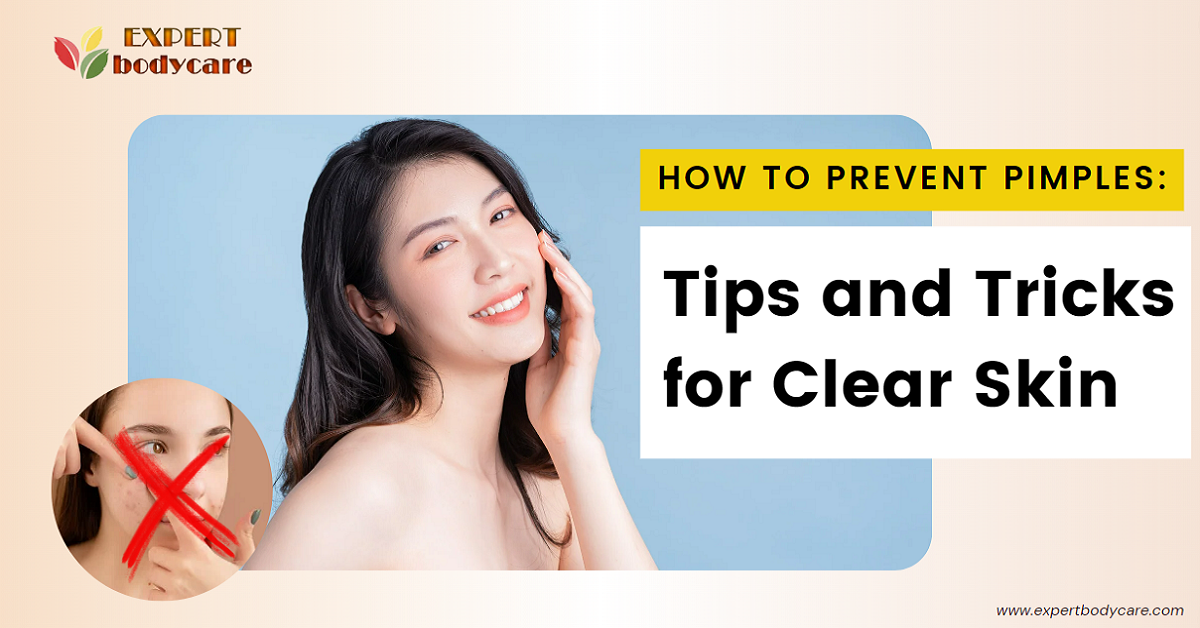Tips to Prevent Pimples
